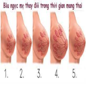 Không đau ngực khi mang thai